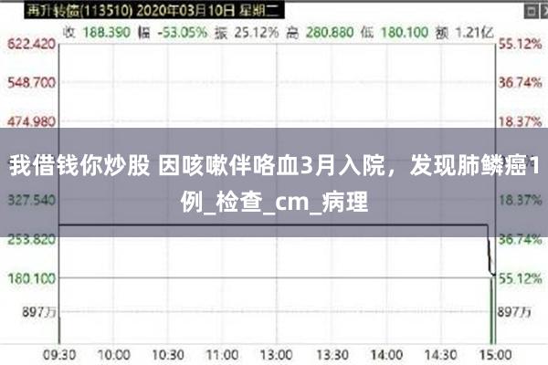 我借钱你炒股 因咳嗽伴咯血3月入院，发现肺鳞癌1例_检查_cm_病理